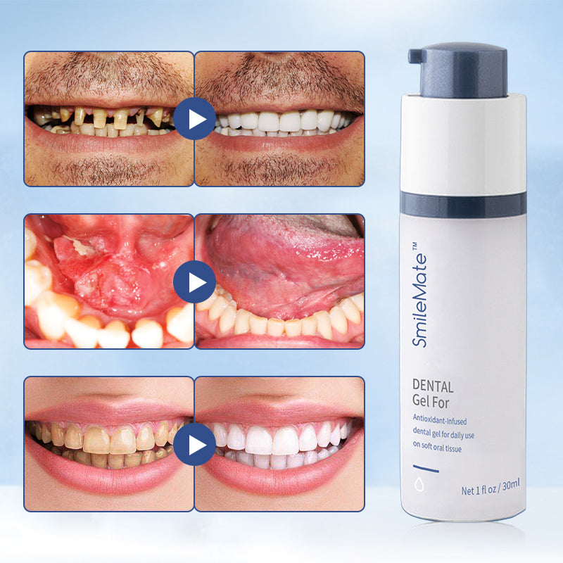 SmileMate™ Teeth Whitening Repair Regrowth Dental Gel2.0