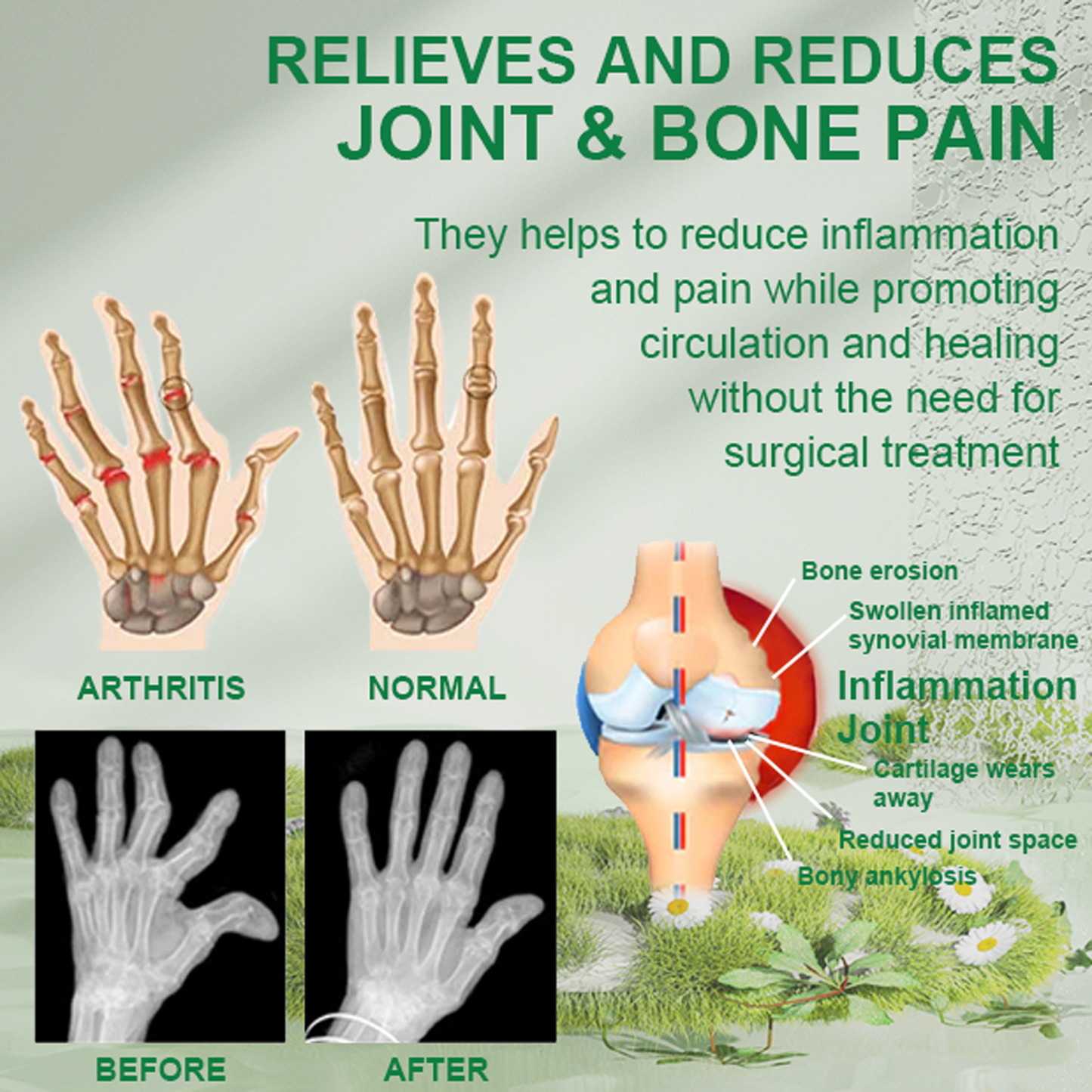 Seurico™ 🐝 New Zealand Bee Venom Joint Bee Venom Pain and Bone Healing Cream